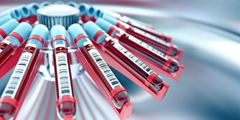 separacion de mezclas centrifugacion